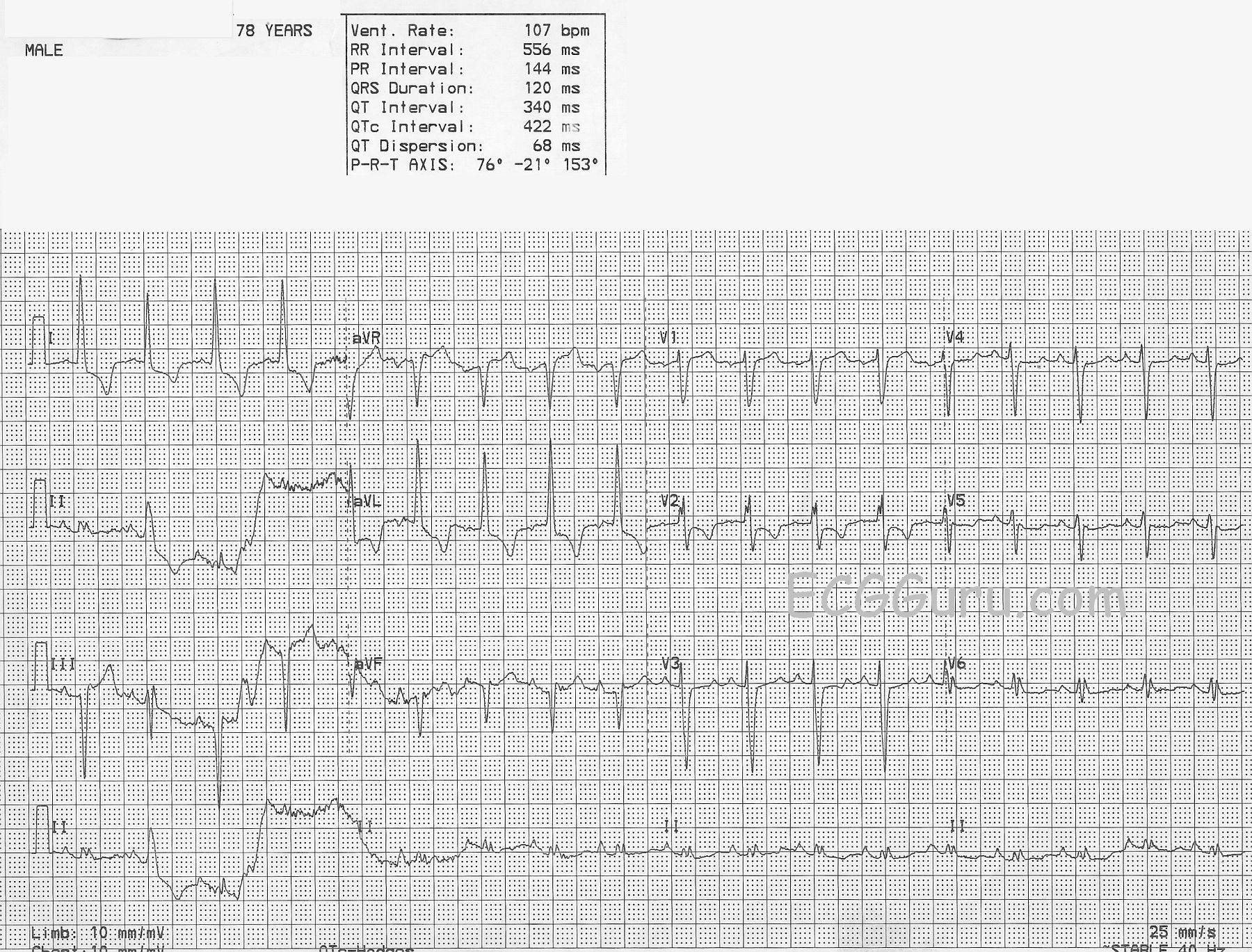 Artifact ECG Guru Instructor Resources